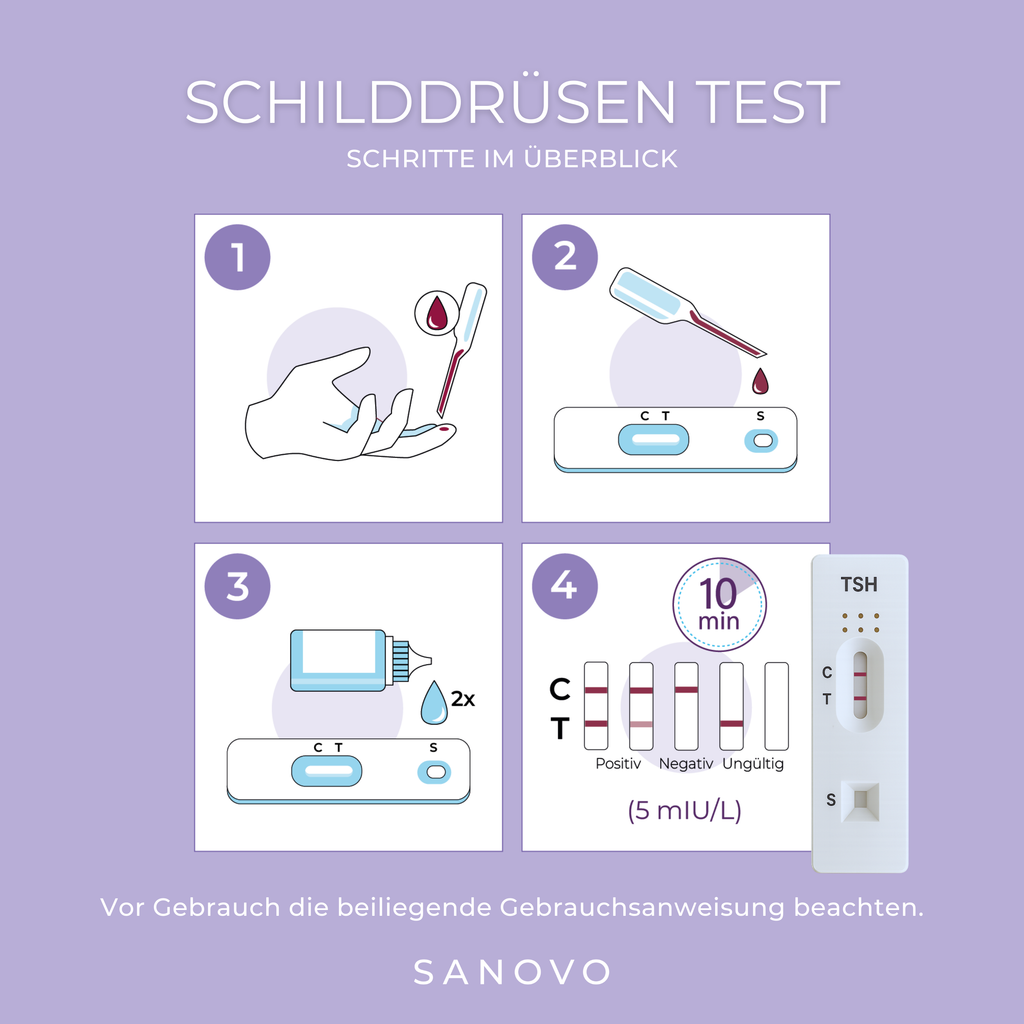 Schilddrüsen Test (TSH)
