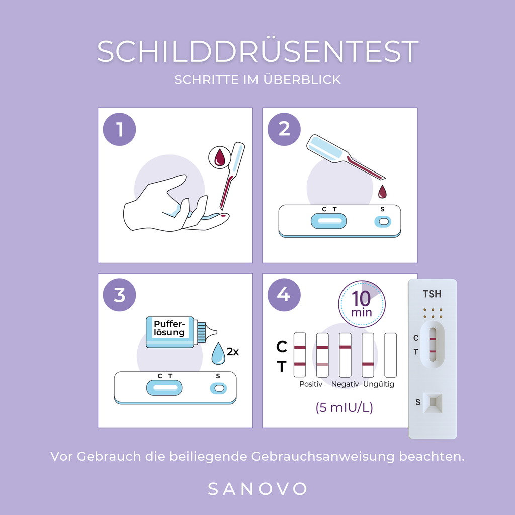Schilddrüsentest (TSH)